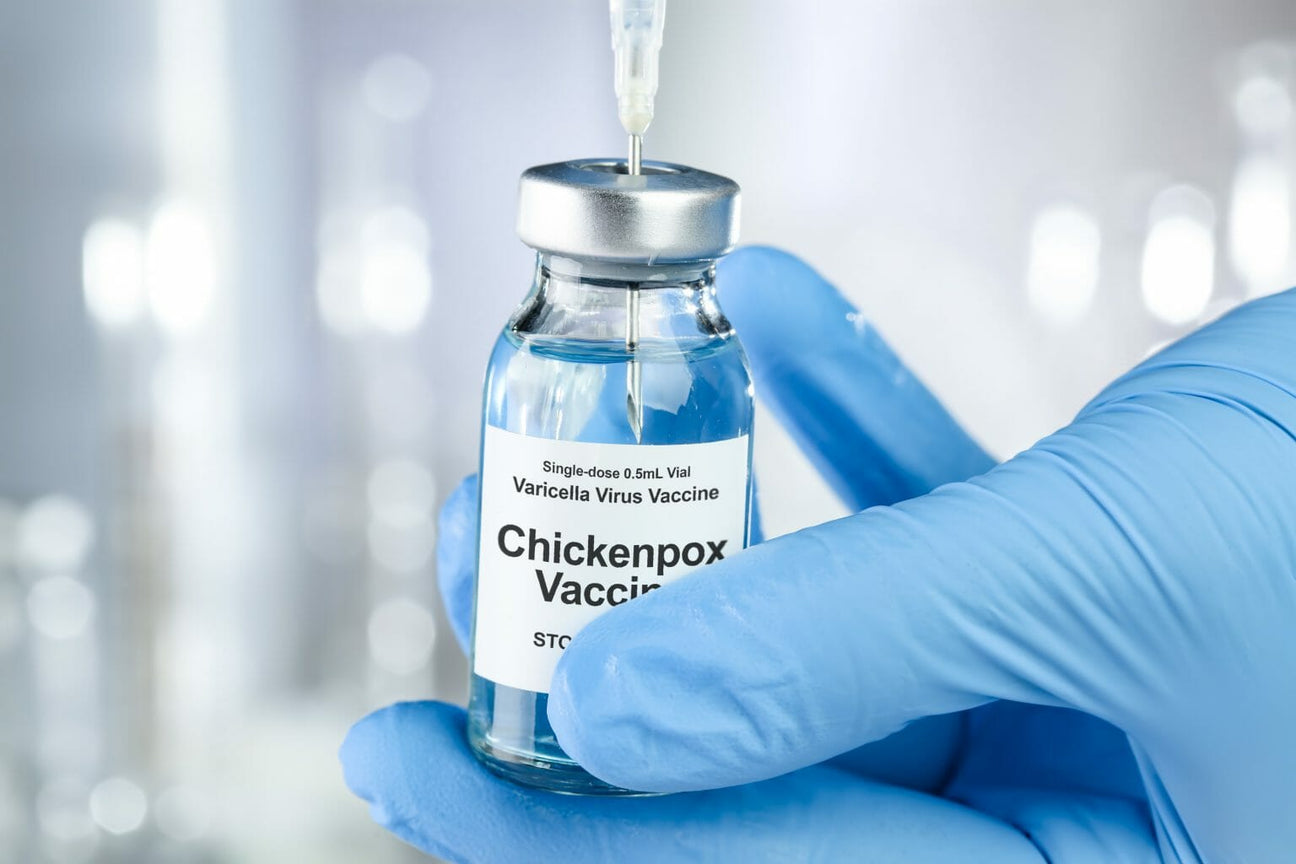 Chickenpox (Varicella) Vaccination Service